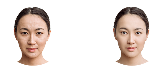 女性候補者の方へ